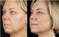Photo of Dr Tom Goyer Sydney Cosmetic Clinic