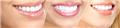 Photo of Brit Phillips DDS