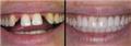 Photo of Tanglewood Smiles