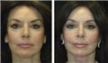 Photo of Marc Mani MD