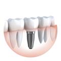 Photo of Dr Paulo Pinho Oral Surgery Clinic