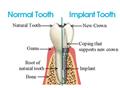 Photo of Bawtry Dental Aesthetic and Implant Clinic