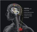 Photo of TDCS Brain Care