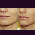 Photo of DermCare - Photo Rejuvenation Platelet Rich Plasma