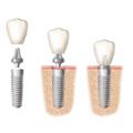 Photo of DENTAL IMPLANT PROFESSIONALS Sydney